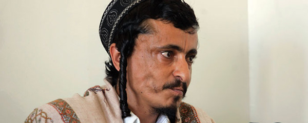 A Jewish Man, Levi Marhabi, is Being Held Hostage by Yemen’s Houthi Rebels
